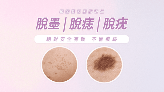 脫墨 ‧ 脫痣 ‧ 脫疣